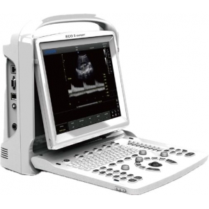 Chison ECO 3 Portable Ultrasound System