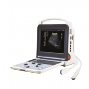 K6 Portable Ultrasound System